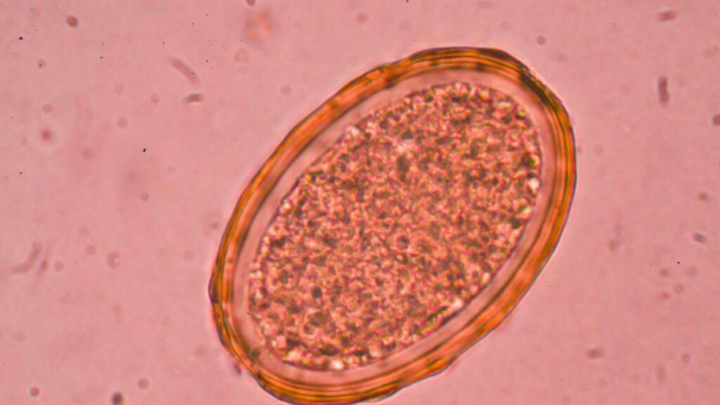 Roundworm under a microscope